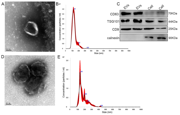 图一：外泌体载药前后鉴定结果 透射电镜结果；粒径结果；western blot结果