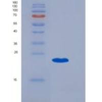 大鼠Epcr / PROCR重组蛋白His tag