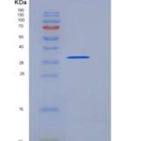 大鼠Ninjurin-1 / NINJ1重组蛋白Fc tag