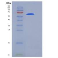 小鼠SPG21 / ACP33重组蛋白His & GST tag