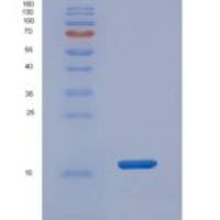 人复合素2(CPLX2)重组蛋白His tag