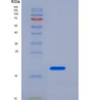 大鼠CLM-9 / TREM4 / CD300LG重组蛋白His tag