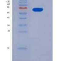 小鼠IL-13Ra1重组蛋白His & Fc tag