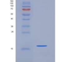 人BOLA1重组蛋白His tag