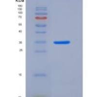 人FANCA / FACA重组蛋白His tag