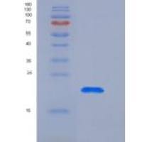 人冠层2同源物(CNPY2)重组蛋白His tag