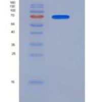 人CROT重组蛋白474 Leu/Val, His tag