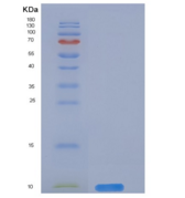 小鼠CD59a / Protectin / MAC-IP重组