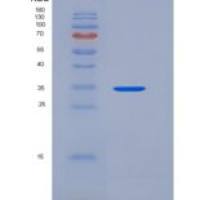 人白细胞介素-8/CXCL8重组蛋白aa 28-99, Fc tag