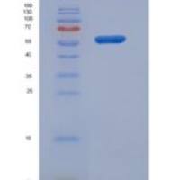 人SerpinD1重组蛋白His tag