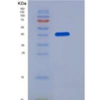 人SCN3B重组蛋白Fc tag