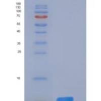 人DNAJC30重组蛋白His tag