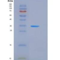 人CSAGE / CSAG1重组蛋白Fc tag