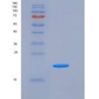 人H1F0 / Histone H1重组蛋白His tag