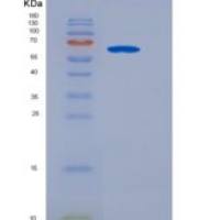 人二肽酶2(DPEP2)重组蛋白Fc tag