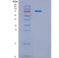 人Semaphorin 4D / SEMA4D / CD100重组蛋白His tag