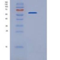 人ALDH4A1重组蛋白