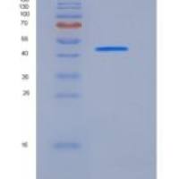 人塞尔皮尼2（SerpinI2）重组蛋白His tag