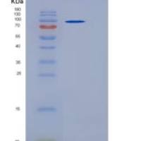 人IL6ST / gp130 / CD130重组蛋白His & Fc tag