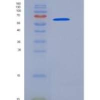 人淀粉样蛋白β前体样蛋白1(APLP1)重组蛋白His tag