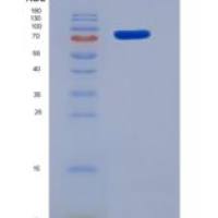 小鼠Smad同源物5(SMAD5)重组蛋白His & GST tag