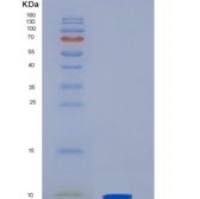 人SMR3B重组蛋白His tag