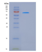 人RET激酶（RET Kinase）重组蛋白His tag