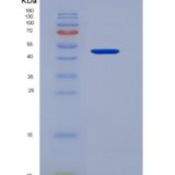 人SUSD4 /含Sushi结构域的蛋白4重组蛋白Fc tag