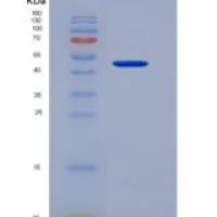 人SUSD4 /含Sushi结构域的蛋白4重组蛋白Fc tag