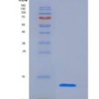 人分泌性白细胞蛋白酶抑制因子(SLPI)重组蛋白His tag