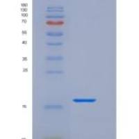 人NPDC-1 / NPDC1重组蛋白His tag