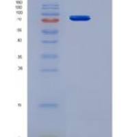 小鼠Smad同源物2(Smad2)重组蛋白His & GST tag