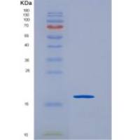 人SCN3B重组蛋白His tag