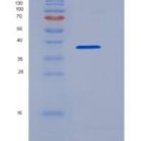 人BVES / POPDC1重组蛋白GST tag