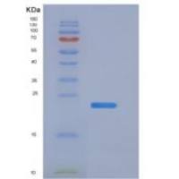 人组织金属蛋白酶抑制因子1(TIMP1)重组蛋白His tag