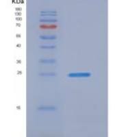 小鼠GLIPR1 / RTVP1重组蛋白His tag