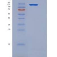 人木桶激酶(CASK Kinase)重组蛋白His & GST tag