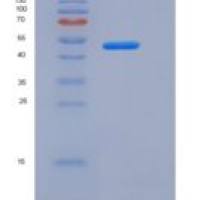 人IL22BP / IL22RA2重组蛋白His & Fc tag