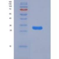 大鼠CD133 / PROM1 / Prominin 1重组蛋白His tag