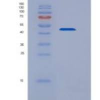 人鳞状细胞癌抗原2(SERPINB4)重组蛋白His tag