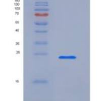 大鼠Layilin / LAYN重组蛋白