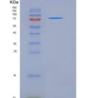 人KIT / c-KIT / CD117重组蛋白aa 540-972, His & GST tag