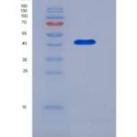 小鼠CD28分子(CD28)重组蛋白His & Fc tag