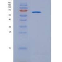 大鼠钙粘蛋白-8 / CDH8重组蛋白His tag