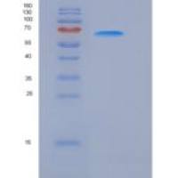 人RET激酶（RET Kinase）重组蛋白His tag