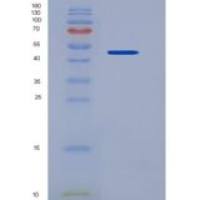 人ILT6 / LILRA3重组蛋白His tag