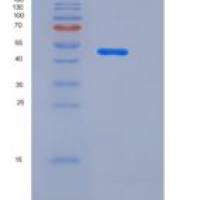 人组蛋白脱乙酰基酶4(HDAC4)重组蛋白aa 612-1084