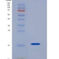 小鼠CD28分子(CD28)重组蛋白His Tag