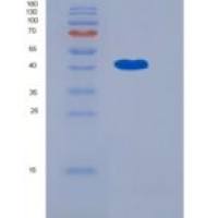 人OMGP / OMG重组蛋白aa 1-420, His tag