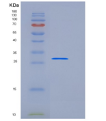 人TWF1 / PTK9 / Twinfilin-1重组蛋白